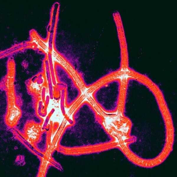 Imagen del archivo descargable sobre Prevención de Riesgos Laborales: Resumen Procedimiento Actuación ante casos sospechosos de enfermedad por Ébola