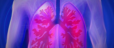 La Seguridad Social somete a consulta pública la inclusión del cáncer de pulmón por exposición al sílice como enfermedad profesional